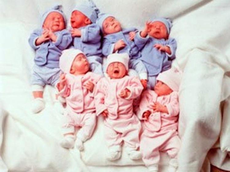 Ezek a csecsemők 9 héttel korábban születtek. Így néznek ki most 20 évvel később a világ első hetes ikrei 