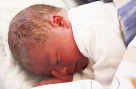 Otthonszülésem története - Az otthonszülés