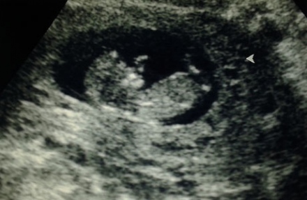 Terhesnapló 6. - Szabadság, szerelem