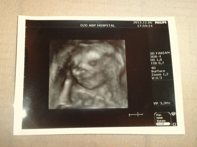 Patrik baby 19 hetes :)