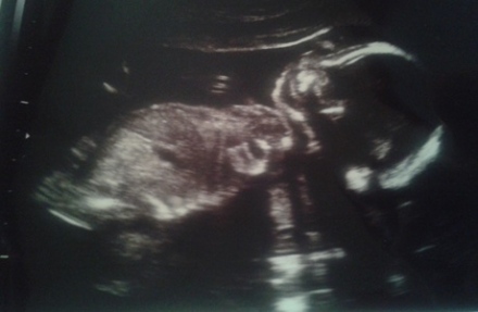 Terhesnapló 6. - Rámférne már a pihenés