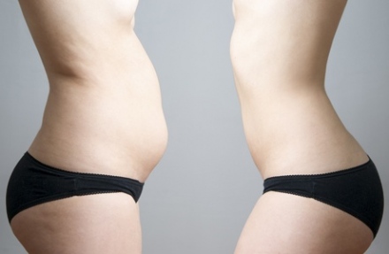 Gyerünk, anyukám! – Te szereted magadat?