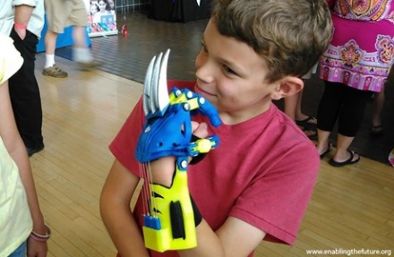 Szuperhősök lesznek a művégtagokkal a gyerekek!