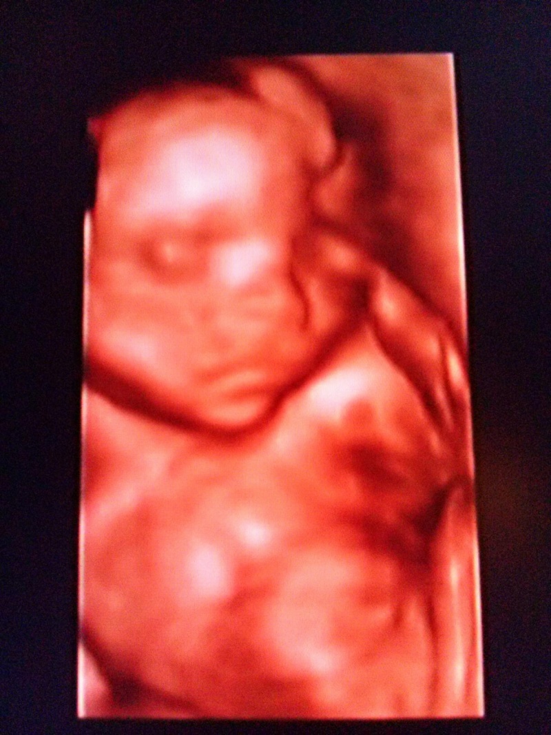 Hunor alszik (24.hét)