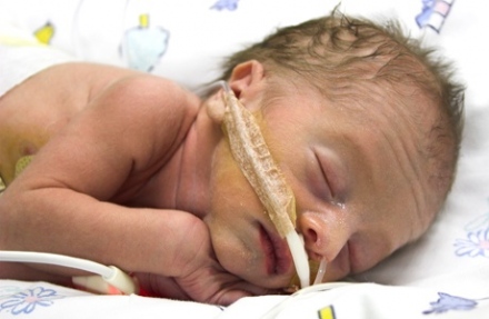 Megtalálták a koraszülések 40 százalékának okát?