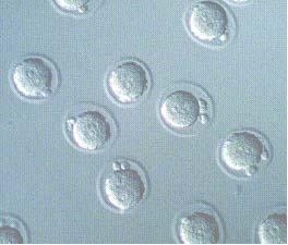 A fagyasztott embriókból egészséges babák születnek