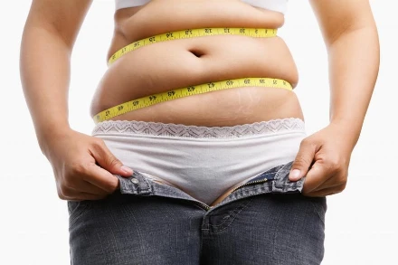 A kövér nőknél több a terhességi komplikáció