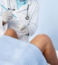 A nőgyógyászati rákszűrés