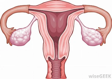 Itt a mesterséges petefészek