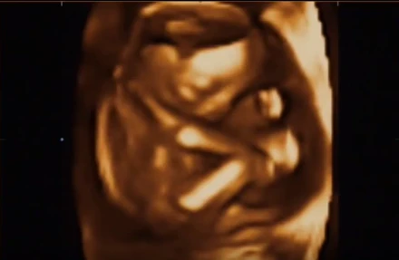 Terhesnapló10 - Liza: Kisfiúnk lesz! (19. hét)  