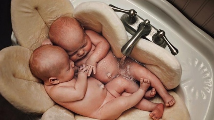 Imádja az internet a tündéri albínó ikreket: elragadó fotósorozat, mely a két csöppségről készült - galéria