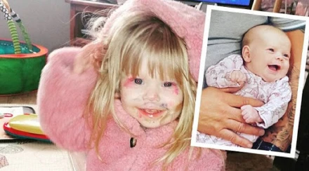 Hatszor kérték az orvosok, hogy vetesse el a babát – a fél szívvel született kislány két műtét után is mosolyog