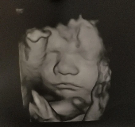 Terhesnapló13 - Niki: Végre mi is boldog család lehetünk 