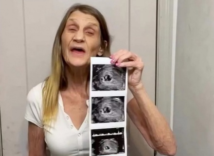 63 évesen lesz újra anya egy nagymama, és a 37 évvel fiatalabb férje örül neki