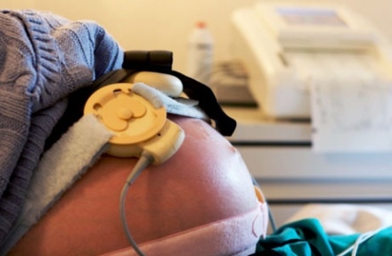 Mi az a CTG és NST?