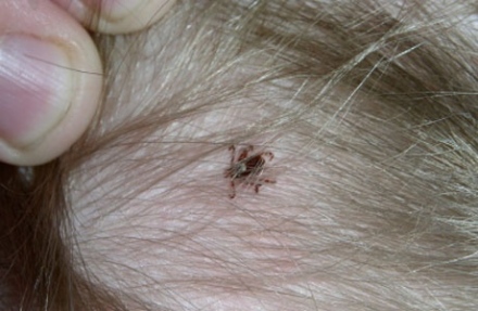 Kullancs-para - irtani kellene!