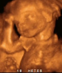 terhesség 32 hét baba slay e